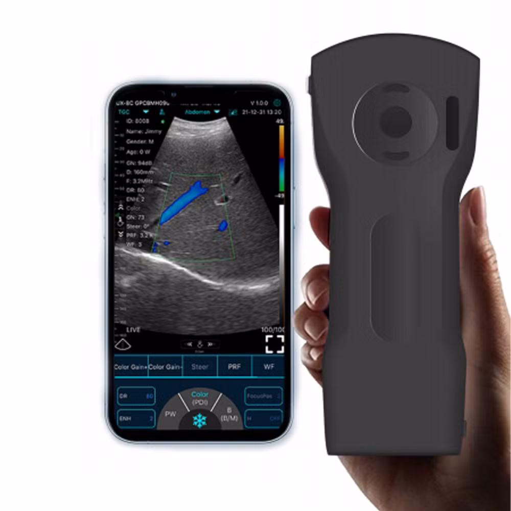 Handheld 3-in-1 Color Doppler Ultrasound Portable Wireless Cardiac Artery Scanner