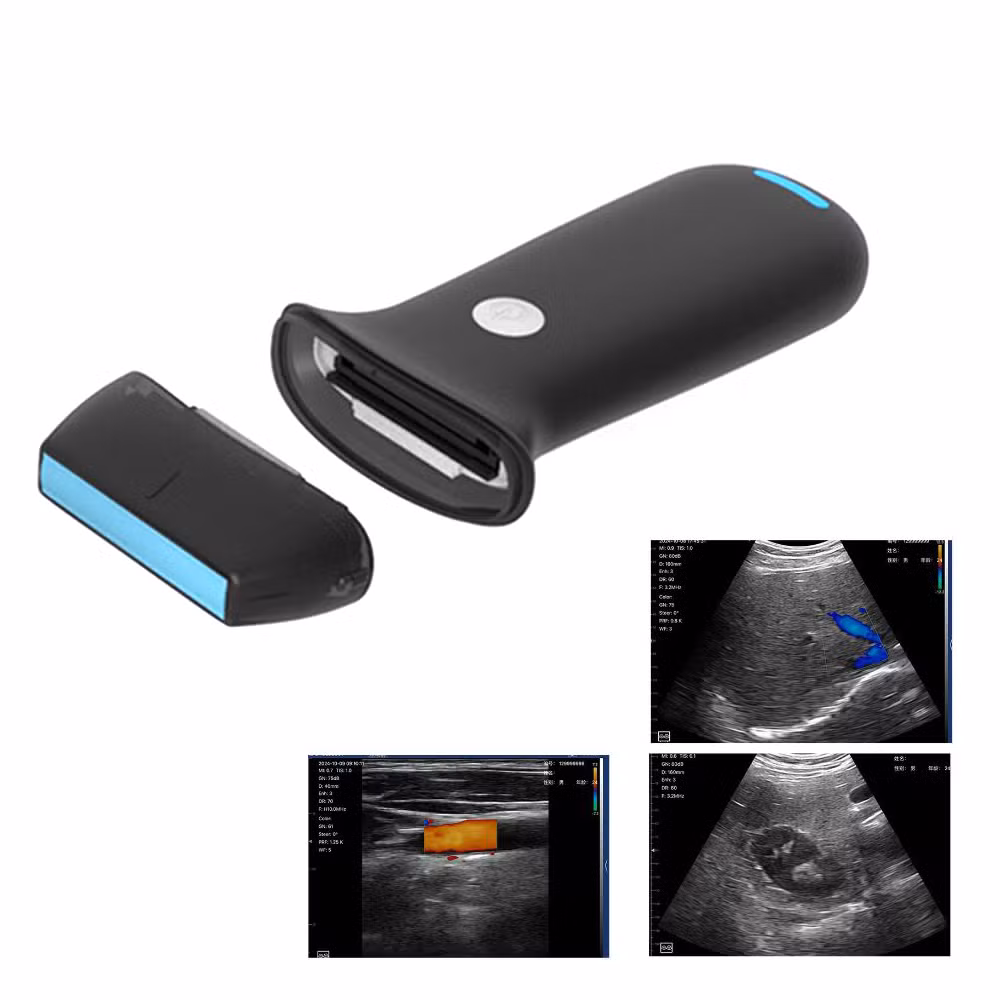 Portable Wireless Probe Medicine Ultrasound Scanner Electric Power Source Medical Diagnostic Equipment