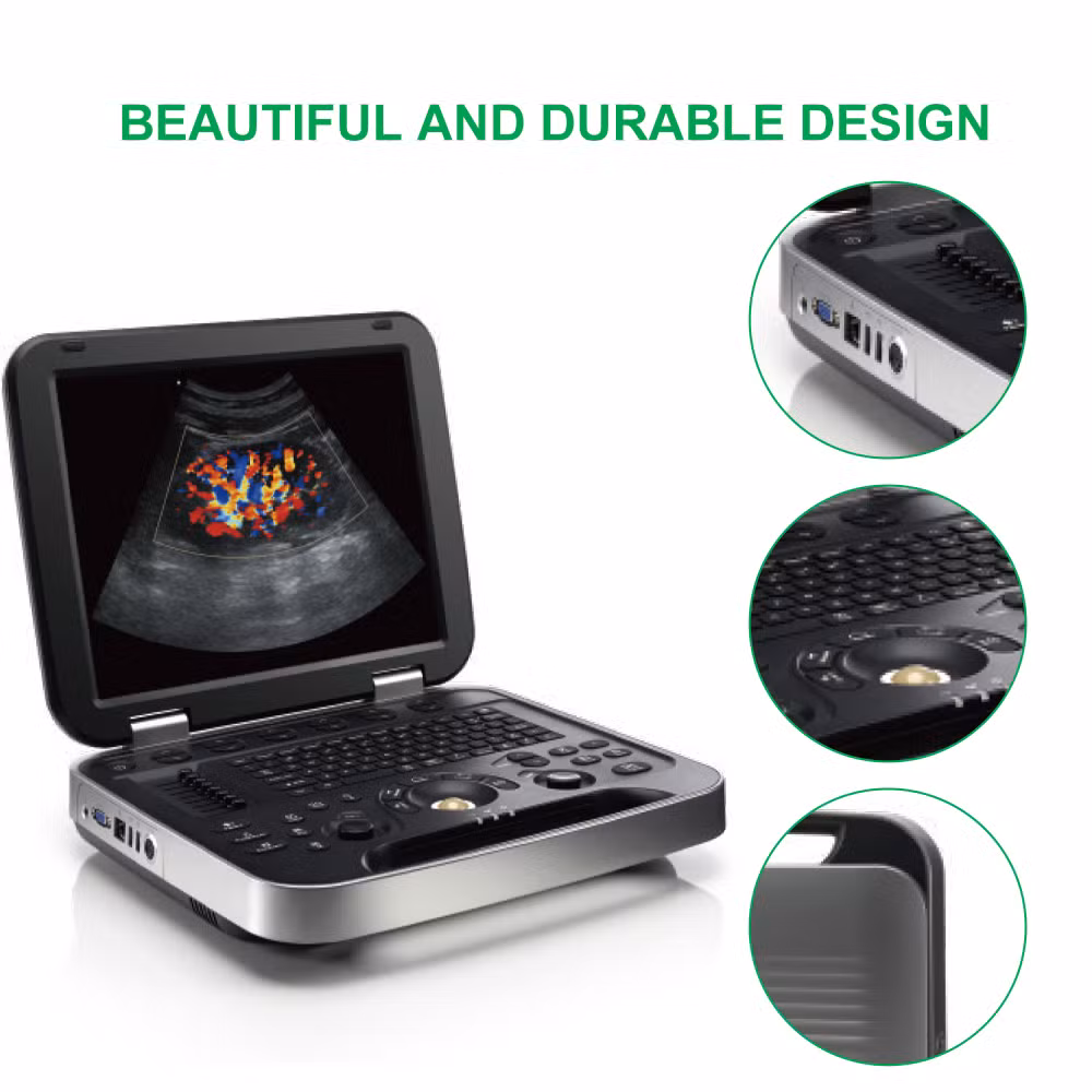 Color Doppler Ultrasound Notebook Medical Equipment Ultrasonic Transducer Color Doppler System