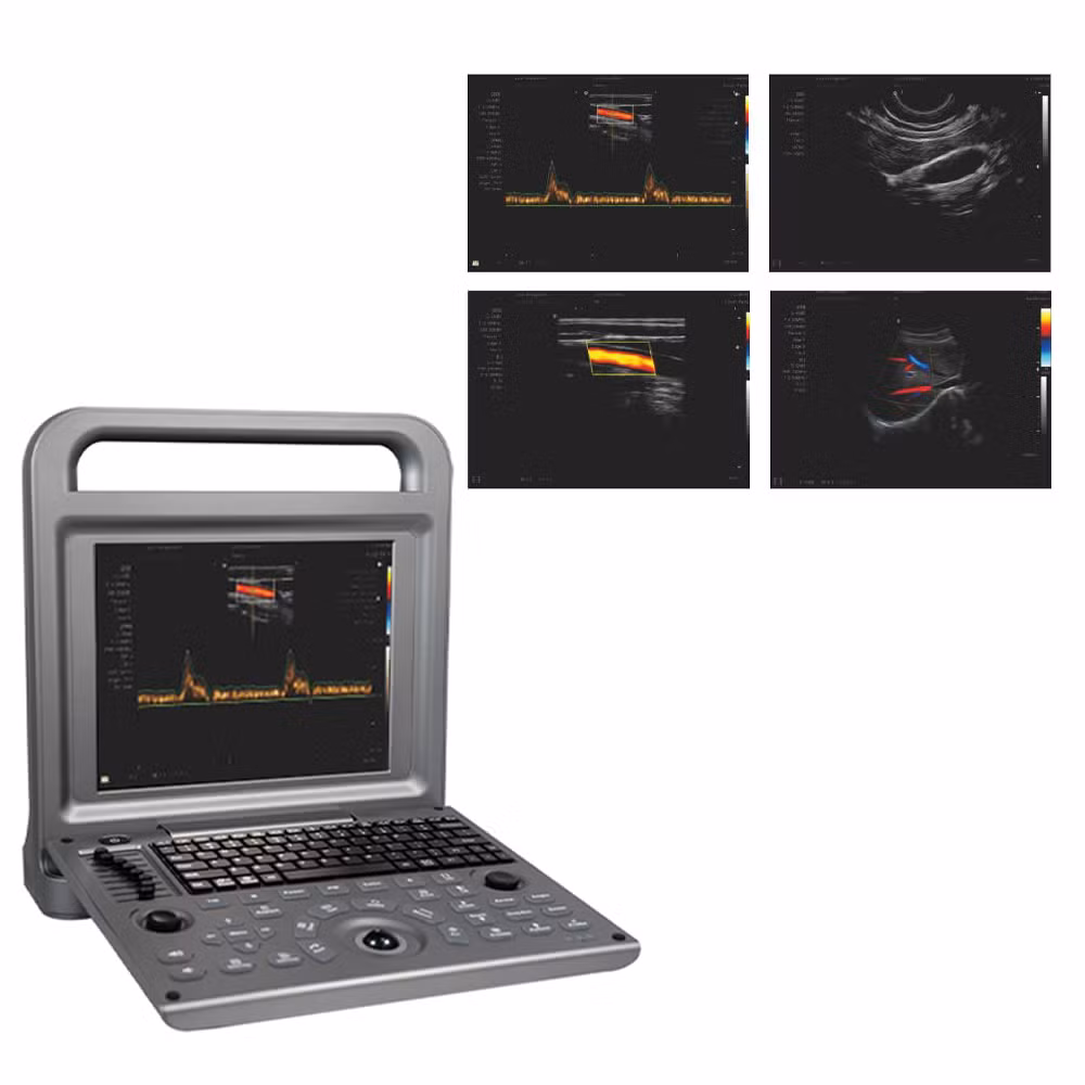 Portable Doppler Color Ultrasound Diagnostic System with Battery Medical Scanner Machine