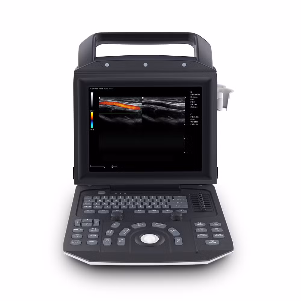 Portable Medical Ultrasound Instrument for Human Scanning Color Doppler Price